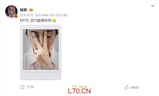 杨幂脸被蒸汽眼罩烫伤了：大家使用时要小心！