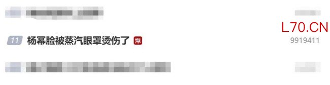 杨幂脸被蒸汽眼罩烫伤了：大家使用时要小心！
